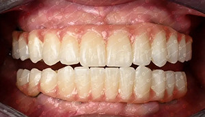 أحدث حالة شركة حول قضية العميل