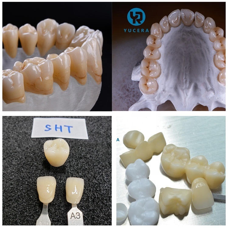 مادة طب الأسنان Yucera 95*14mm Cad Cam Sht ml أقراص زركونيا كاد كام كتل سيراميك الأسنان
