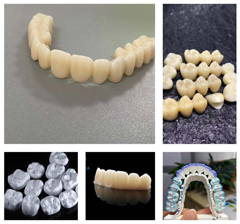 YUCERA 98mm HT عالية الشفافية مواد طب الأسنان Cad Cam الشركة المصنعة لمختبر الأسنان المواد الاستهلاكية كتلة الزركونيا سعر المصنع