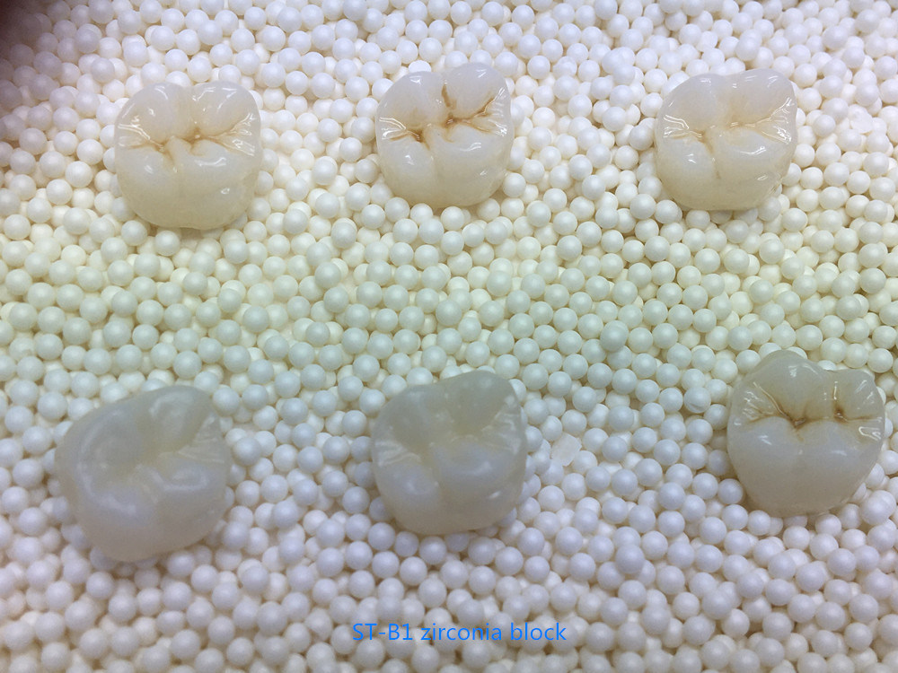 كتل زركونيا YUCERA 1200MPa 98 HT لطب الأسنان، مواد استهلاكية لطب الأسنان، زركونيا مسبقة التلوين، كتلة زركونيا لطب الأسنان