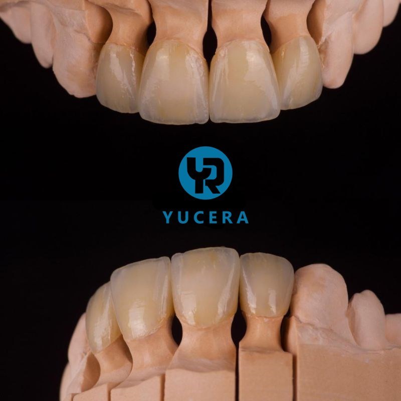 كتل زركونيا YUCERA 1200MPa 98 HT لطب الأسنان، مواد استهلاكية لطب الأسنان، زركونيا مسبقة التلوين، كتلة زركونيا لطب الأسنان
