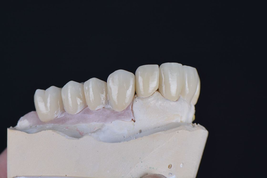 43%-57% شفافية 700-1200 ميجا باسكال قوة الانحناء YUCERA Dental نظام 98mm مفتوح CAD/CAM 4D Pro متعدد الطبقات كتلة الزركونيا