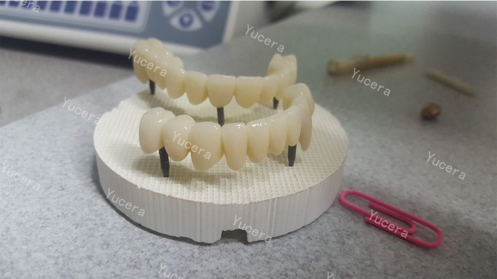 Yucera 4D Pro Multilayer Dental Zirconia Ceramics Open System 98mm for Dental Lab and Cinic