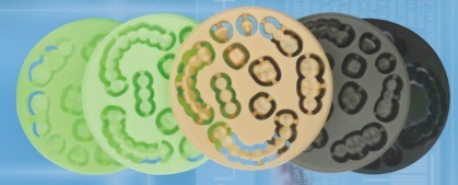 قرص PMMA عالي الجودة من Yucera مع خدمة OEM لمواد طب الأسنان لمختبر الأسنان