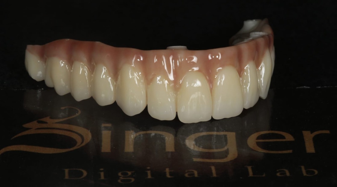 كتلة سيراميك الزركونيا المحددة من Yucera 4D Pro Dental - بتقنية HT Plus لتحسين جودة الترميمات